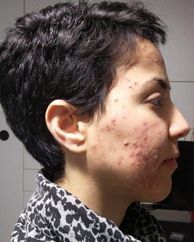Εφη Μπουζάκη ΠΡΙΝ Εφη Μπουζάκη